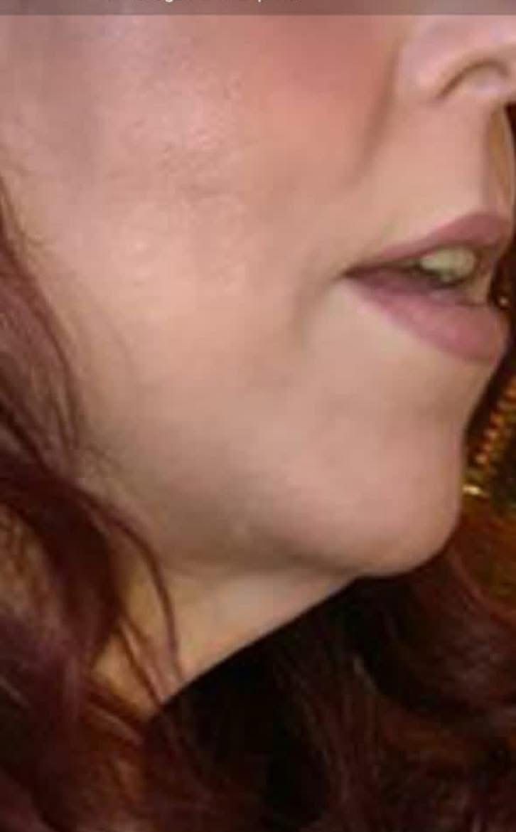 ANTES